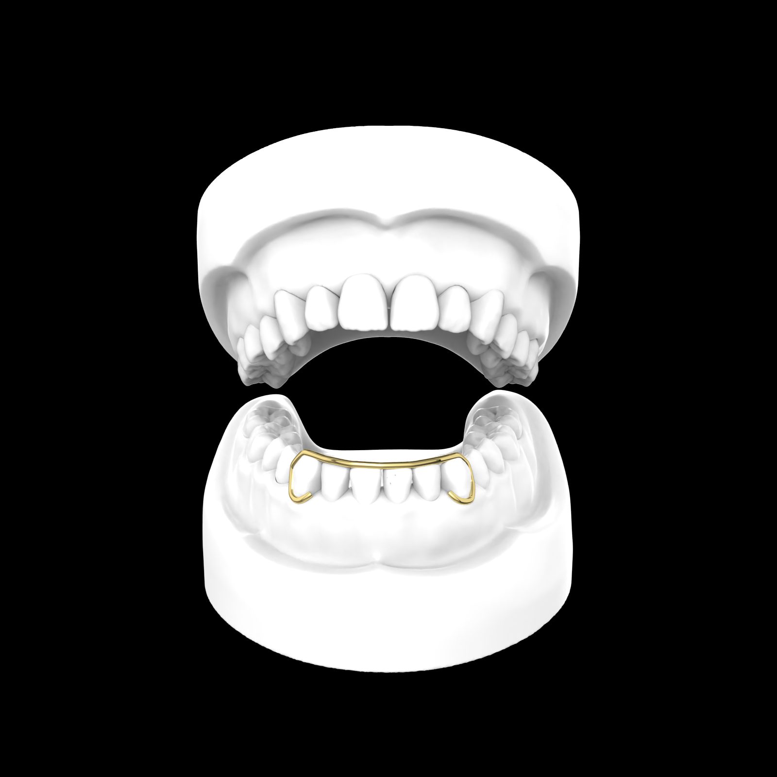 X6 Outline Bar