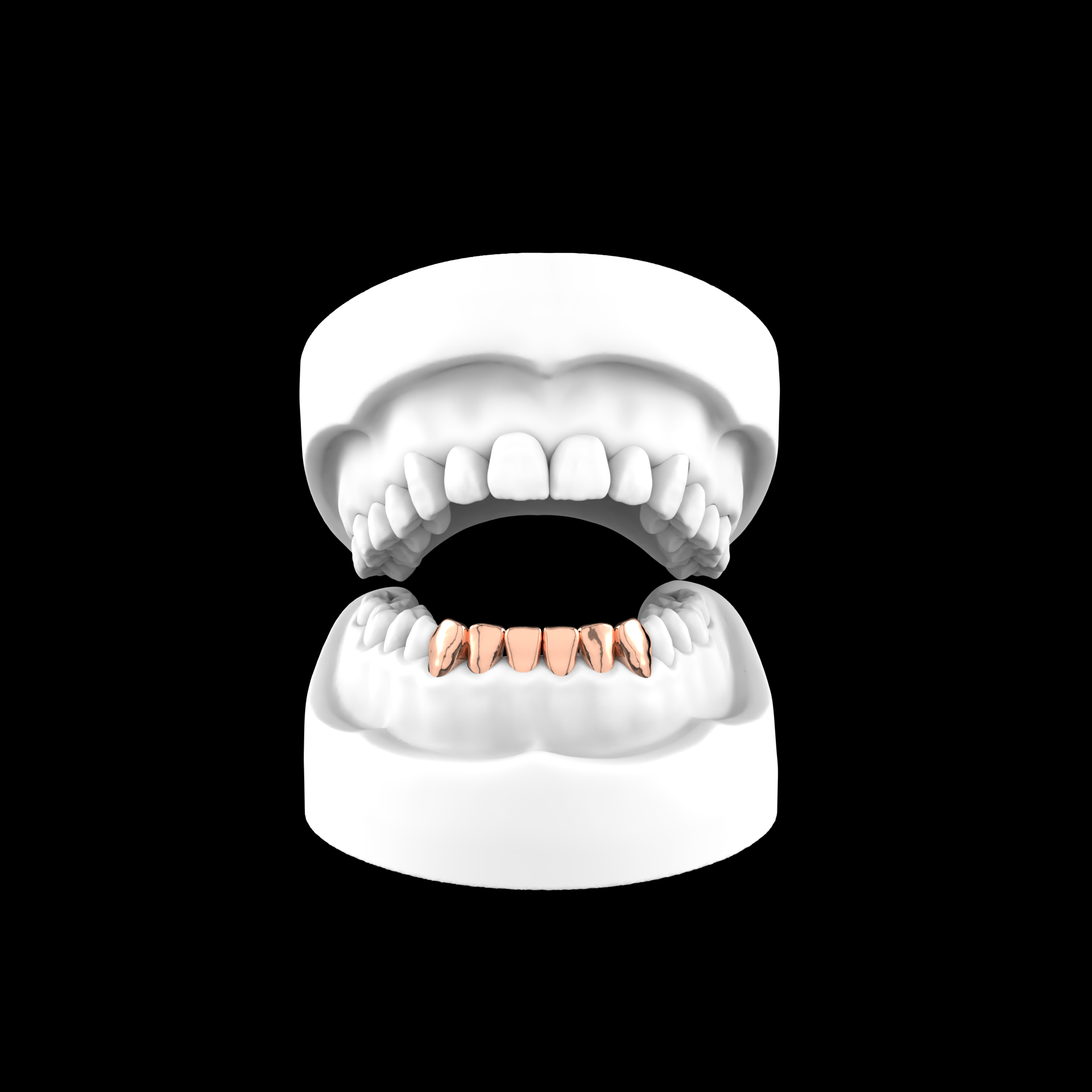 x6 Grillz