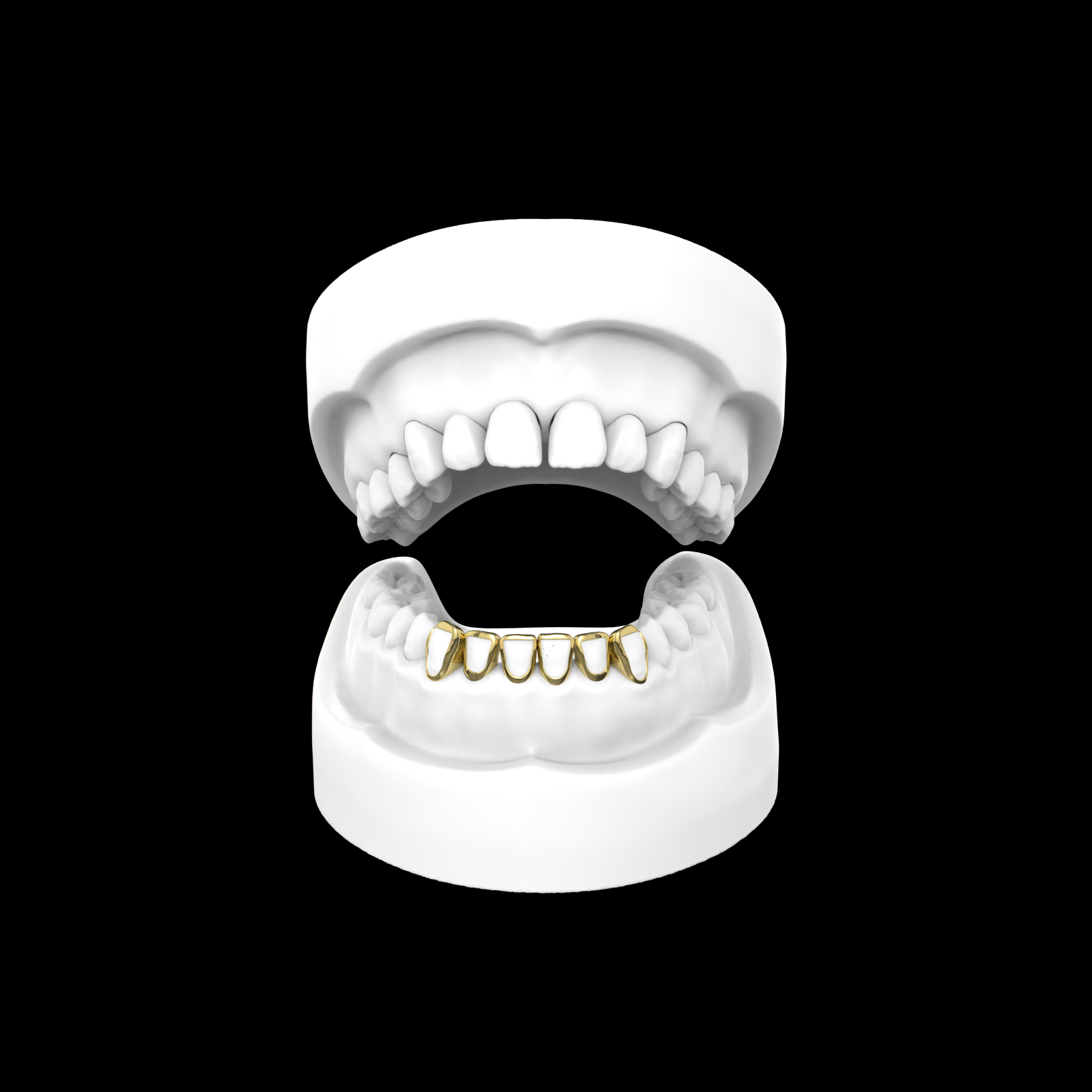 X6 Window Grillz
