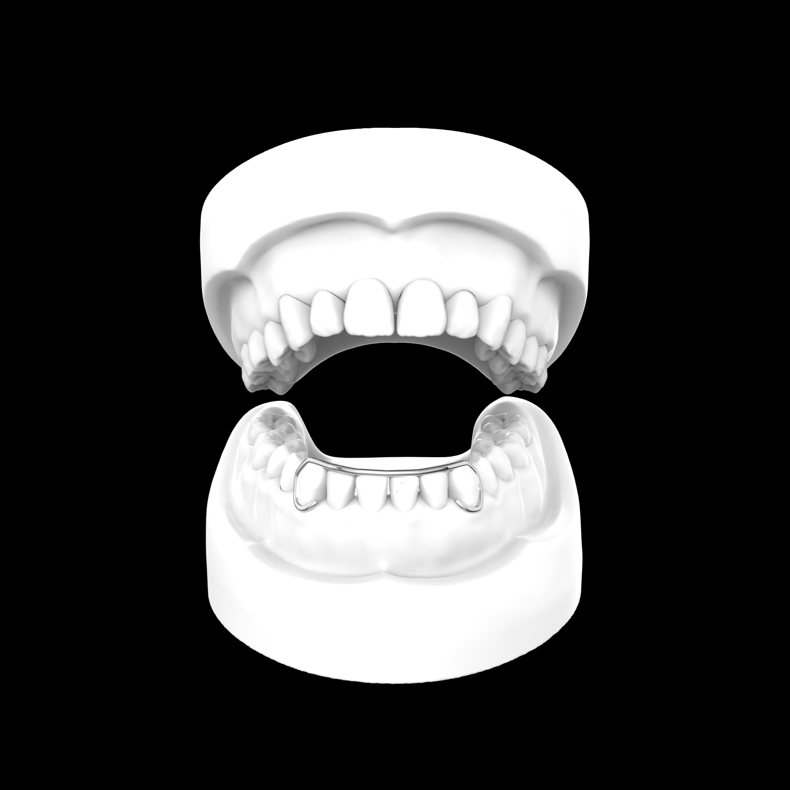 X6 Outline Bar
