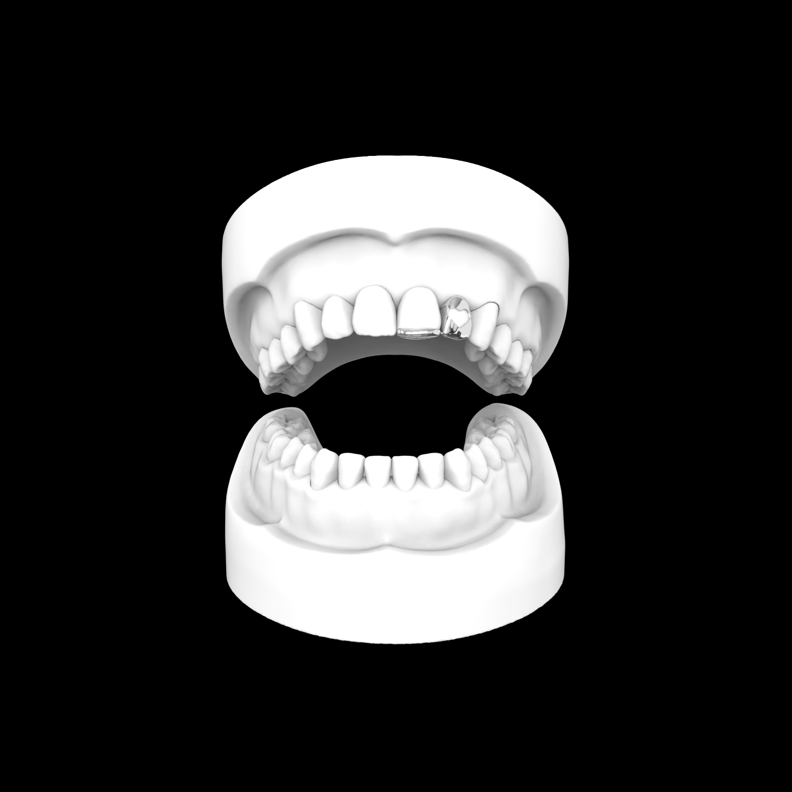 Inlay + Open Face Heart