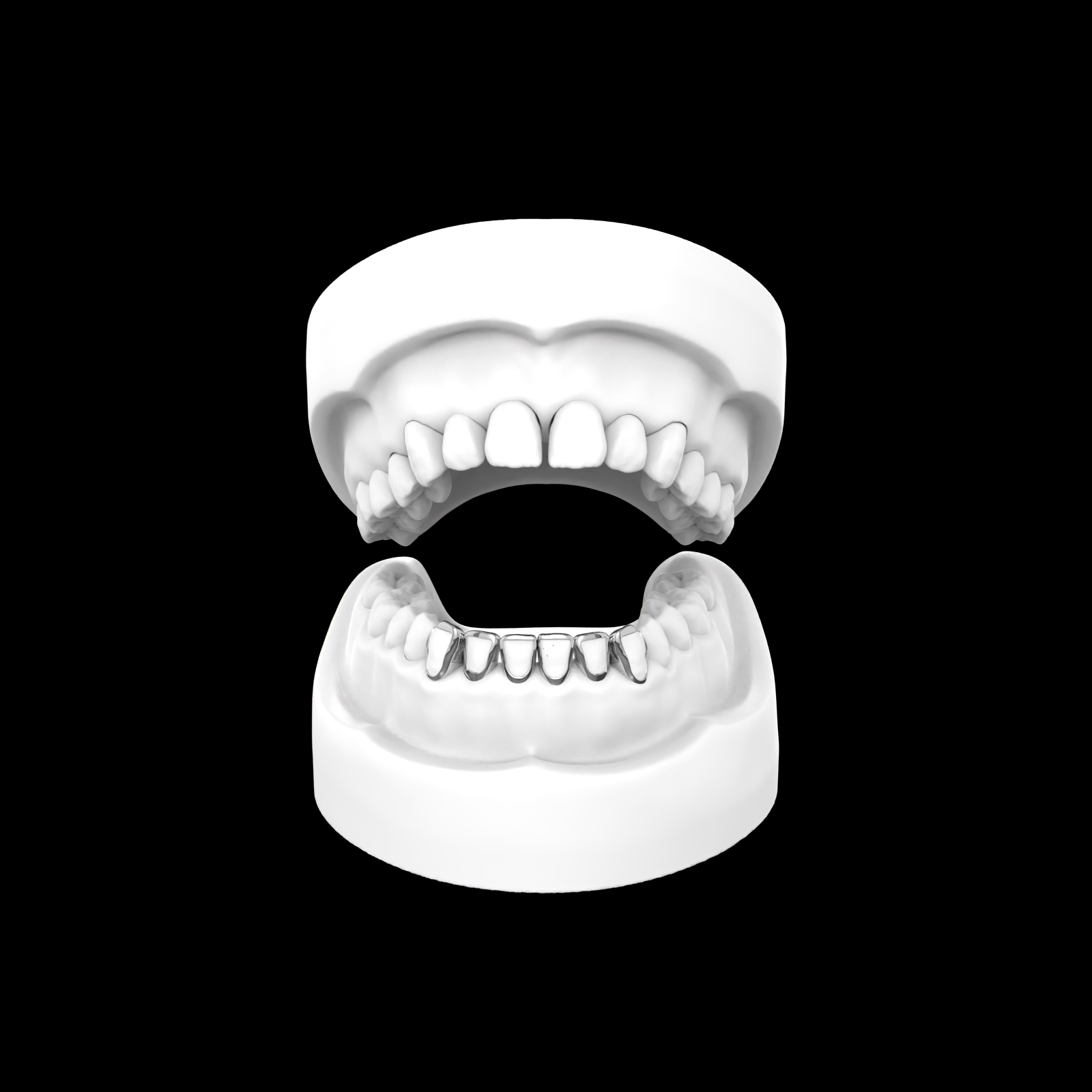 X6 Window Grillz