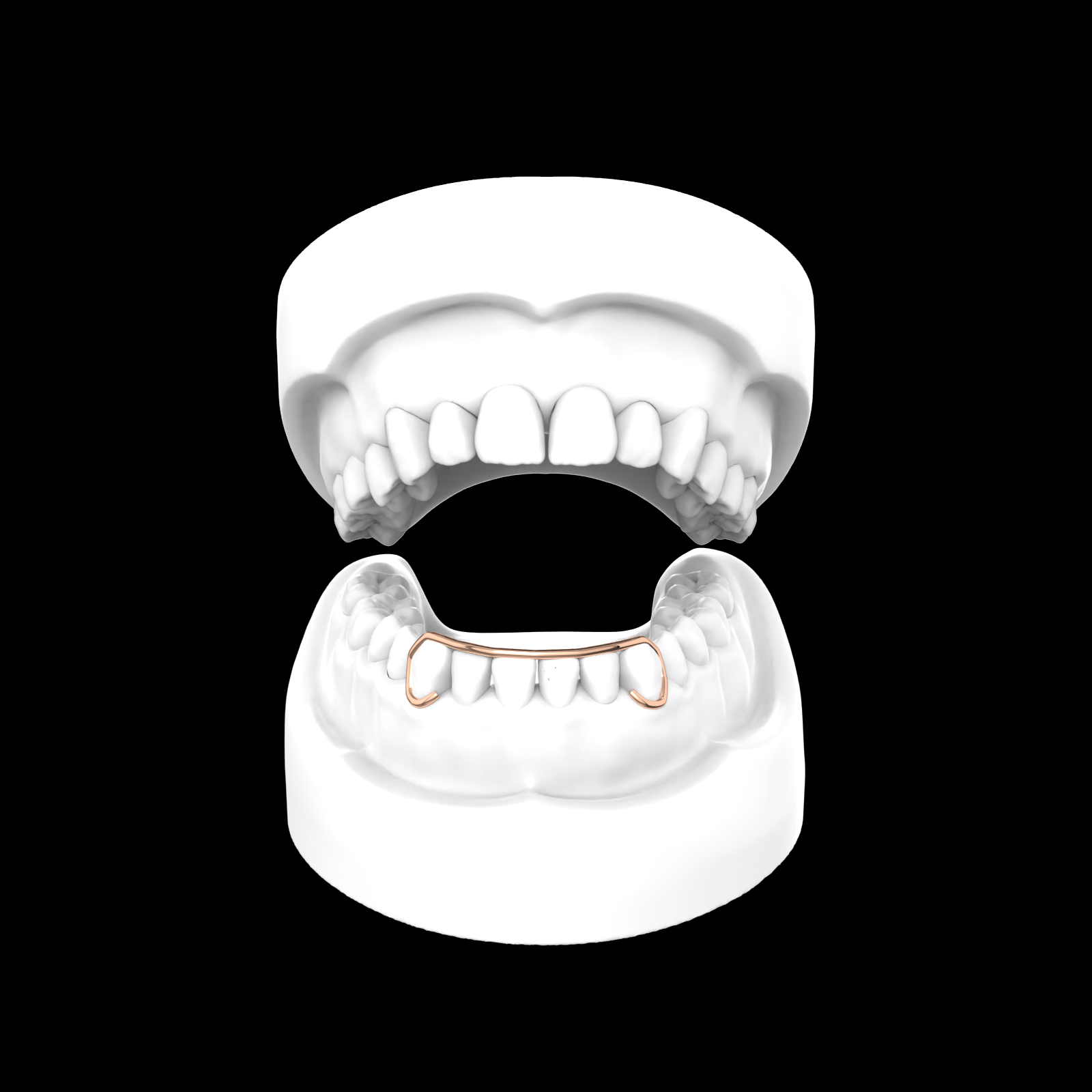 X6 Outline Bar