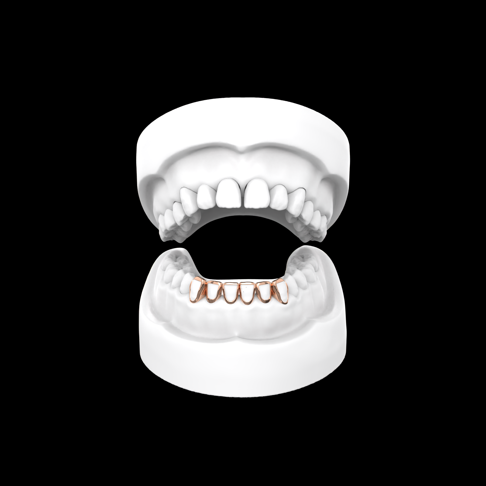 X6 Window Grillz